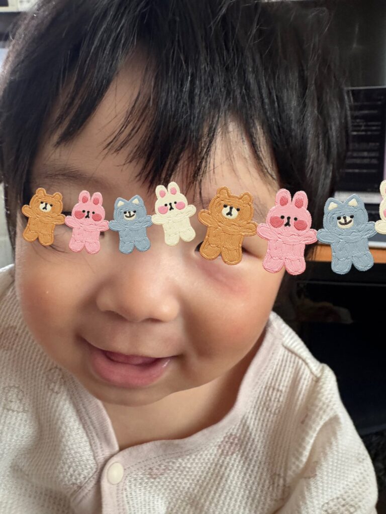 赤ちゃんの蕁麻疹の実際の写真。頬にも出た（目元は隠しています）